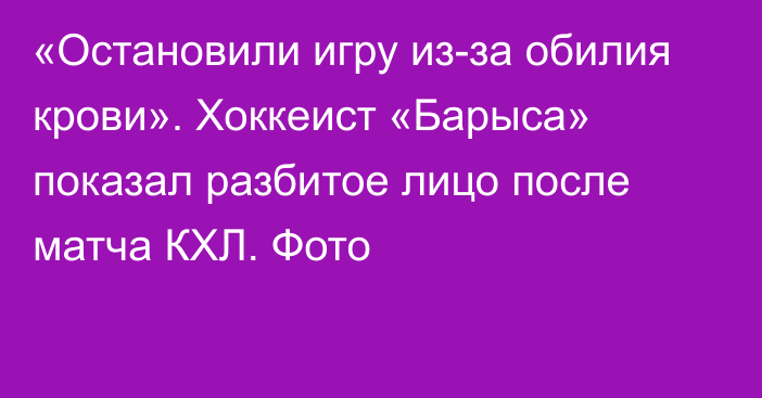 «Остановили игру из-за обилия крови». Хоккеист «Барыса» показал разбитое лицо после матча КХЛ. Фото