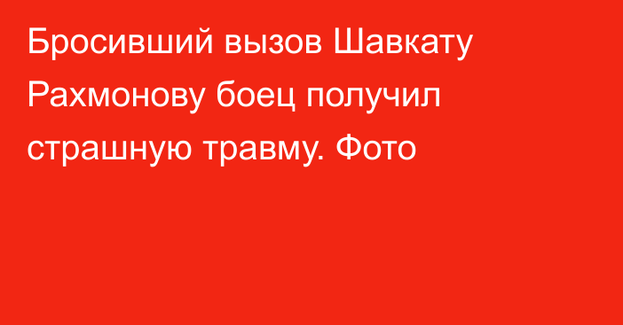 Бросивший вызов Шавкату Рахмонову боец получил страшную травму. Фото