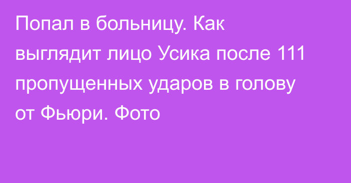 Попал в больницу. Как выглядит лицо Усика после 111 пропущенных ударов в голову от Фьюри. Фото